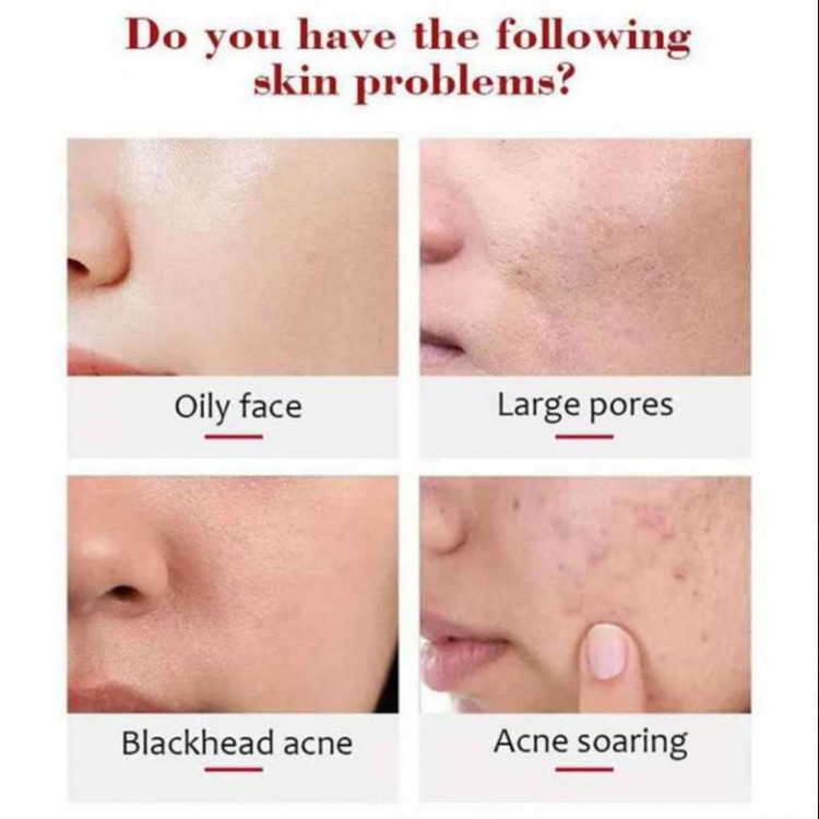 ژل لایه بردار و سفید کننده صورت و بدن ایچون بیوتی عصاره پرتقال